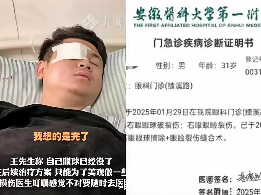 祸不单行！被烟花击中摘除右眼的男子还可能失业。
除夕夜，安徽男子王先生带着回家过
