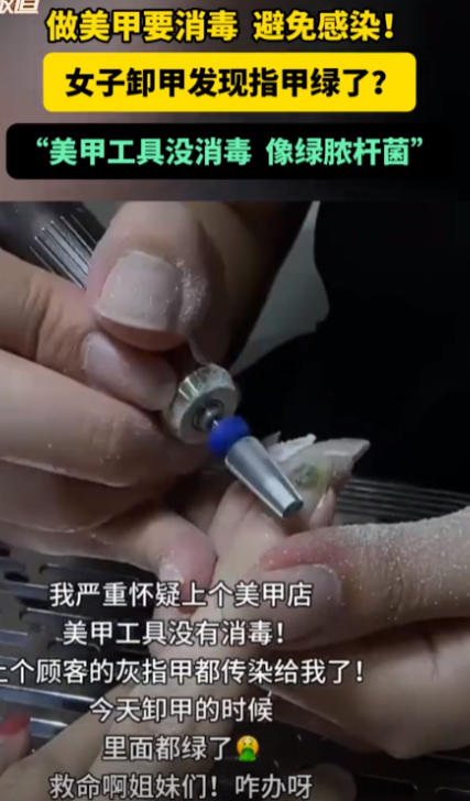 这也太吓人了！江西一女子去美甲店做指甲，结果却因为美甲店的工具没有进行消毒，不小