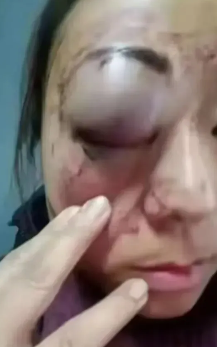 太生气了!一女子在菜市场买鸭，鸭子杀好了她却说不要了，为此与老板吵起来，女子霸气