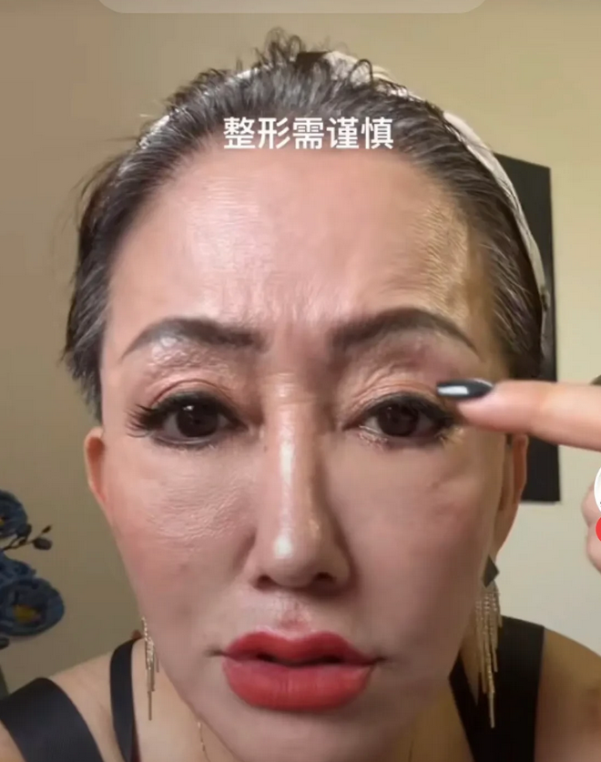 这是一个做线雕整容后的美女，看她的五官，原来应该是一个大美女，因为看不惯自己一天