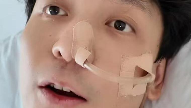 主持人不慎吞下鱼刺：穿出胃扎到肝