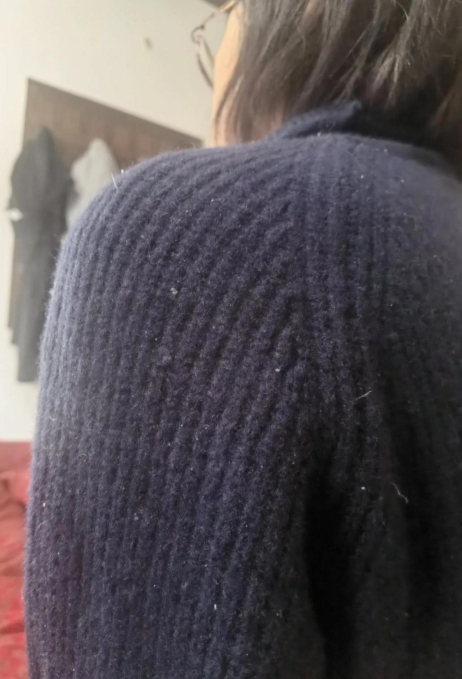 泡芙衣绒服啊，简直就是个大“坑货”！那面料，娇贵得跟个小公主似的，不耐脏就算了，