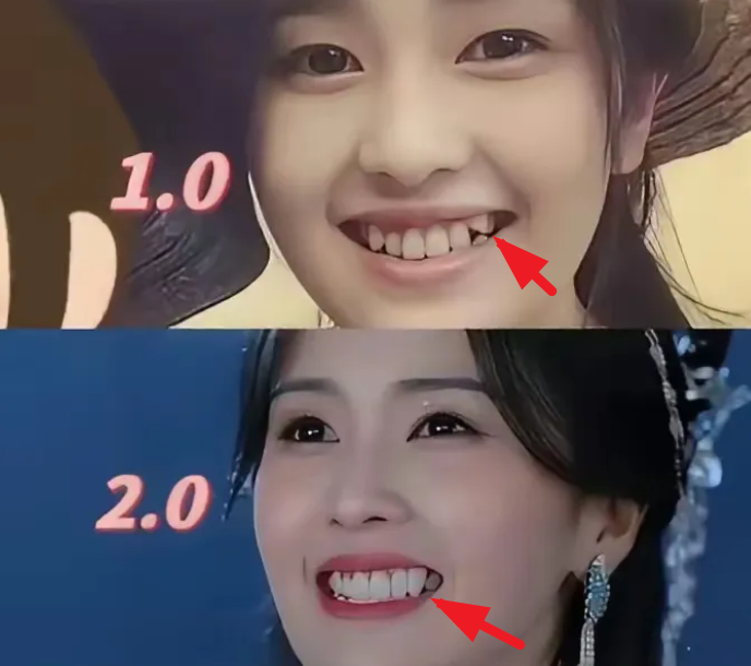 白鹿牙齿没整之前是短的，整完怎么还变长个呢？