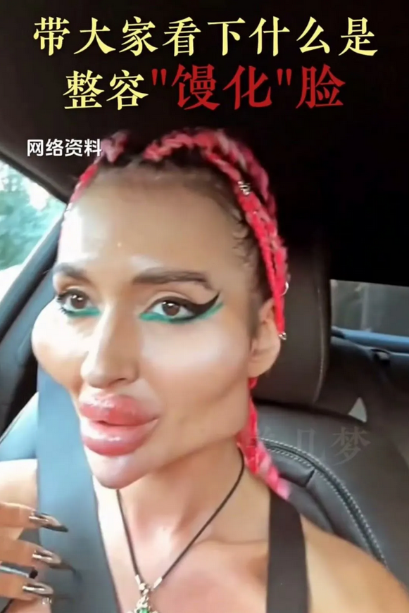 整容过度就成怪物了！
乌克兰的一个网红，整容真的只有一次和无数次。
整容的审美很