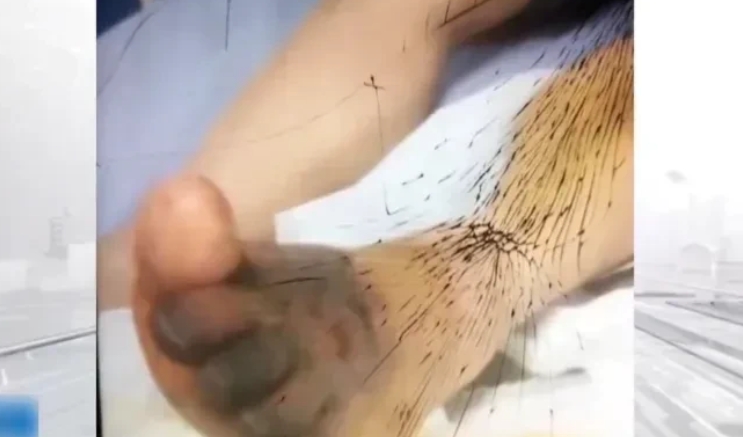 水牛突然暴走，牛贩子直接被顶翻，一只脚竟惨遭截肢！