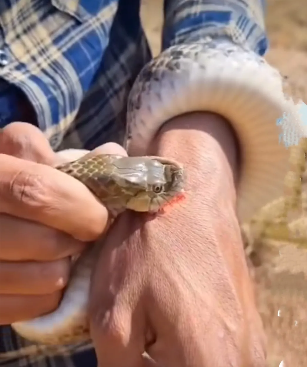 被这种蛇咬了需要挂什么科?