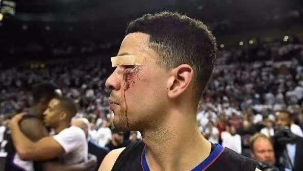 眼角缝了11针还坚持比赛，小里弗斯不是坑爹的废物！