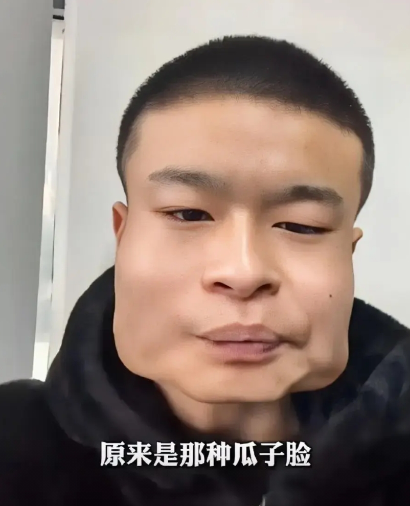 12月13日，新疆一正方形脸的男子发布视频称：自己吃槟榔已经有八年的时间了，每个