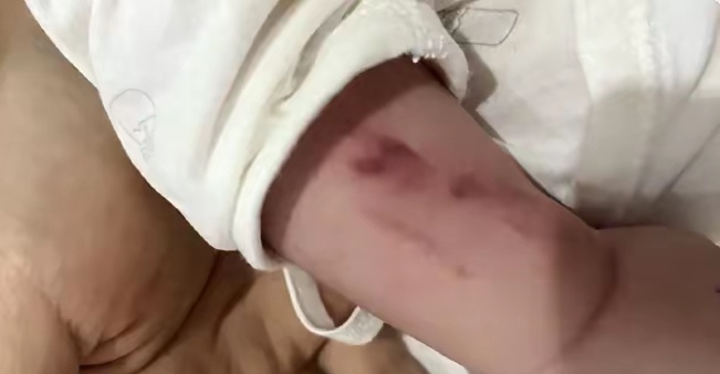广西一男婴在月子中心被照料20天：身上2处骨折，育婴室监控无法查看！出生健康的男