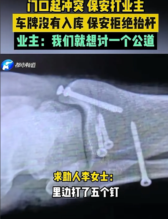 河南，男子凌晨4点到小区，由于他的车牌号没有录入车库，抬杆就升不起来，他让保安帮