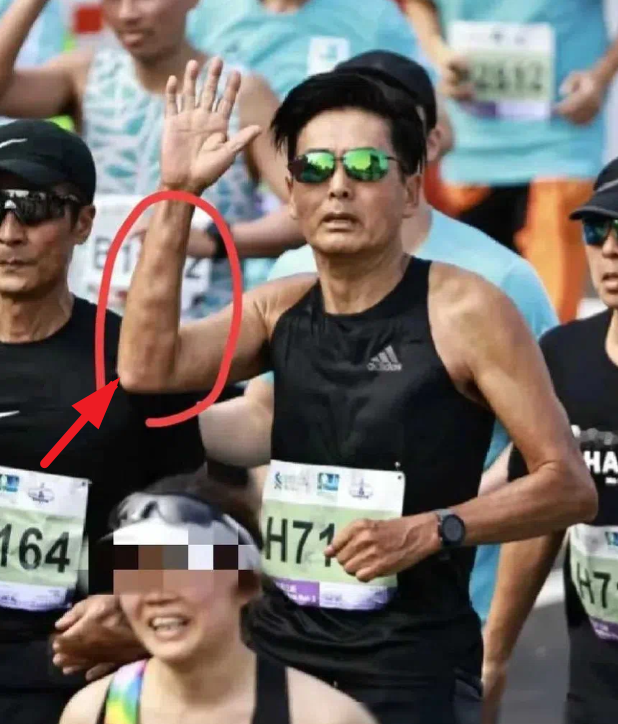 周润发手臂上惊现不少肉疙瘩，这是咋回事啊？