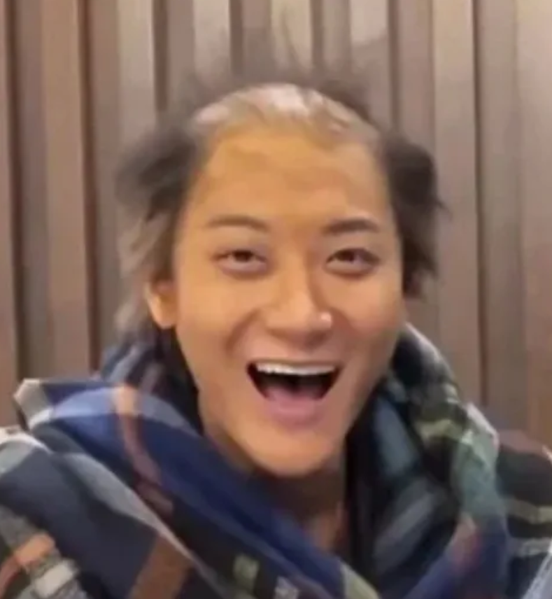 看到黄子韬这个地中海发型，终于明白有句话是这么说的：一秃毁所有，果然如此，哪怕一
