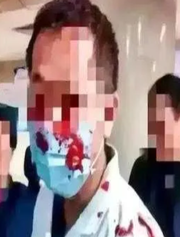 近日，在陕西西安的一家医院，一场看似平常的阴超检查却意外演变成了一场“血案”。一