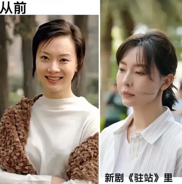 其实，陈数的脸，撑到今天也不容易。

她年轻的时候，就长得不太端正。
我看《暗算