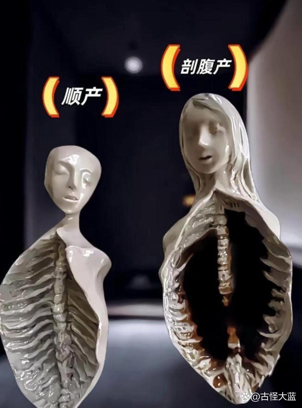 这张图让我终于知道医生为什么都劝能顺就顺了.....