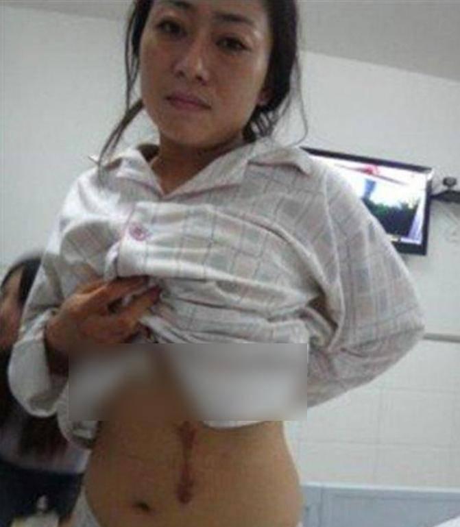 “无良医生，还我女儿肾脏！”一病人家属怒闯医院，然而主刀医生却“不翼而飞”？
＂