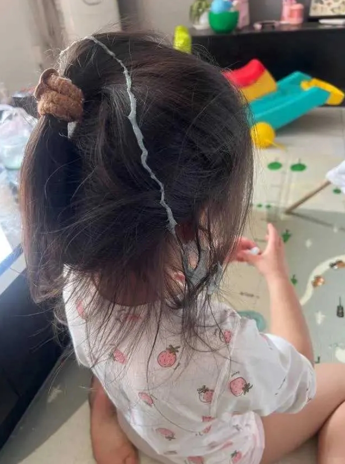 没办法自己生的，这种怎么除？
