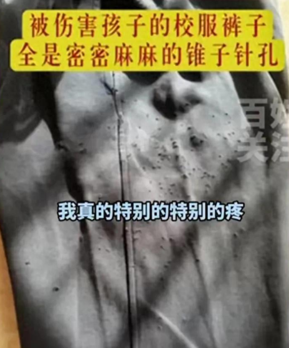 山东济南，一家长发现自己女儿的校服上面全是针孔，掀开衣服一看傻眼了，发现女儿大腿