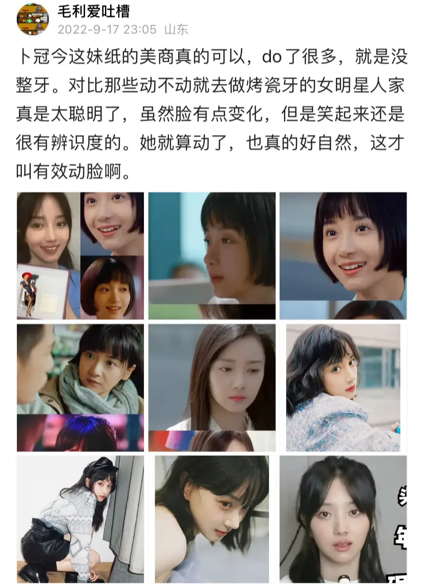 卜冠今这妹子简直是换了张脸，新综艺完全不敢认。
两年前我还夸她美商高，变美了还有