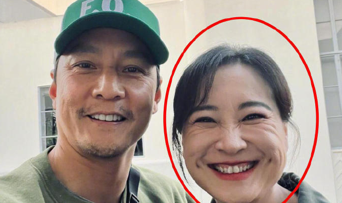 难怪贾玲减肥后不怎么笑，一笑满脸都是褶子