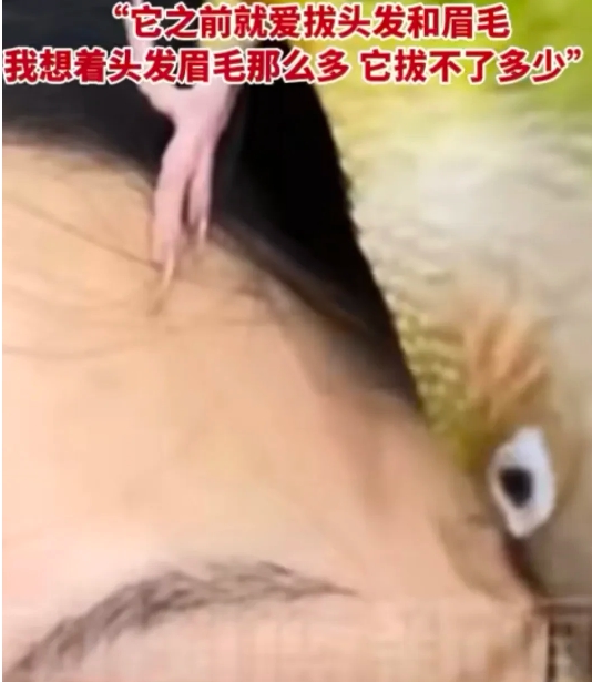 鹦鹉持续啄了一个多小时拔光主人眉毛
