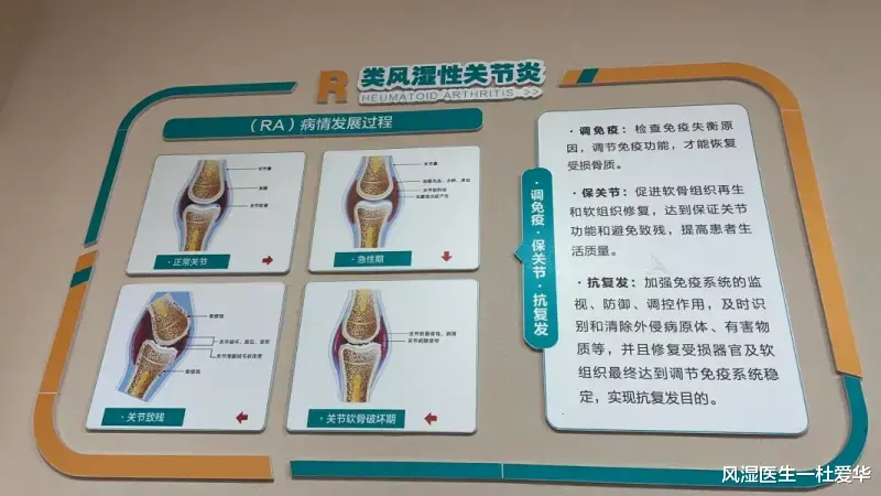 类风湿做好这六点, 比吃药还重要!