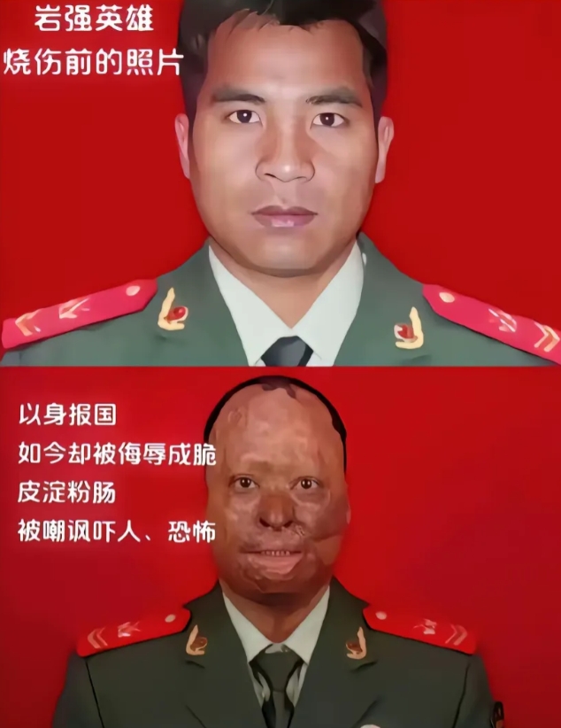 可恨！太可恨了！英雄理应受到尊重！
岩强是天津港大爆炸中消防员，因为救火脸部被烧