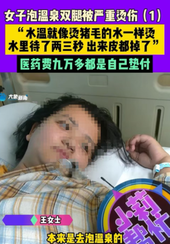 11月17日一女子去泡温泉的时候，不小心滑倒，掉进了水温高达70度的温泉池里。她