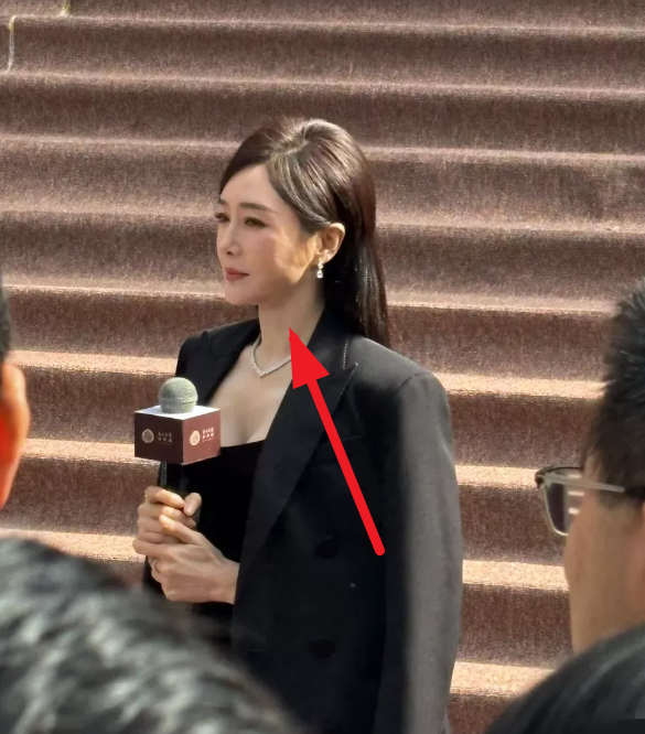秦岚的脸怎么感觉坑坑洼洼的？不像是皱纹阴影吧
