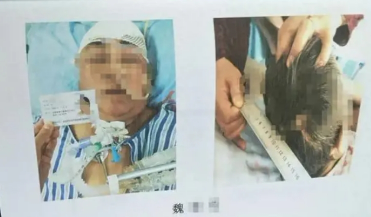 目睹母亲过马路时被撞飞数米头部着地的惨烈一幕后，27岁身体健康的女儿竟在5天后去