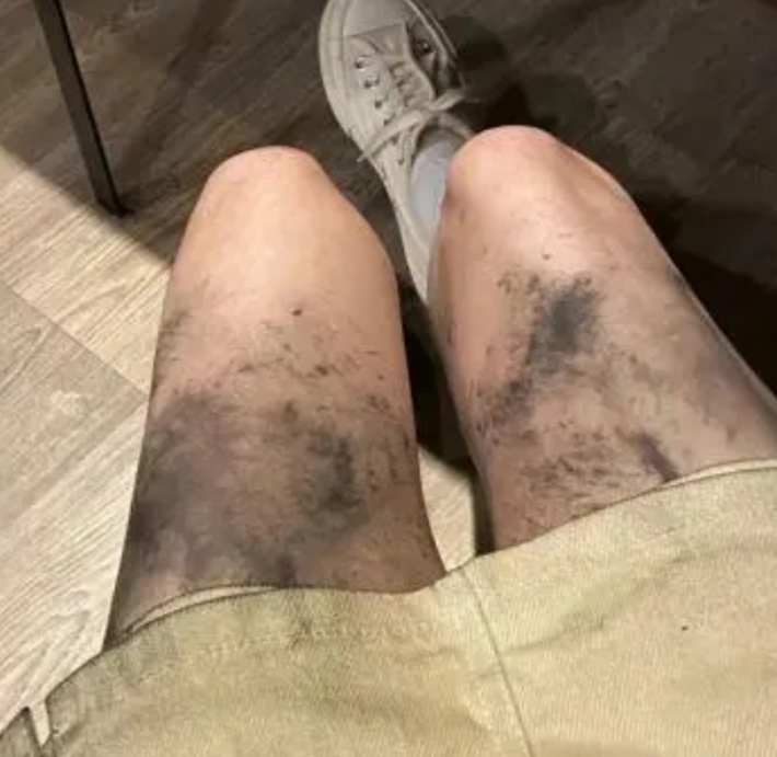 这是去挖煤来吧！哈哈哈哈 [大笑][大笑][大笑]