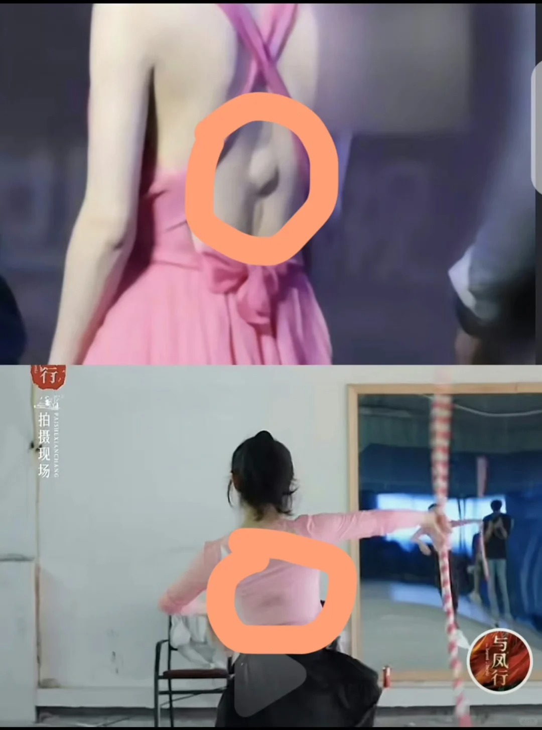 天呐，她这里怎么鼓了这么大包…
腰上这里鼓包是永久性地吗？
我记得这好像是赵丽颖