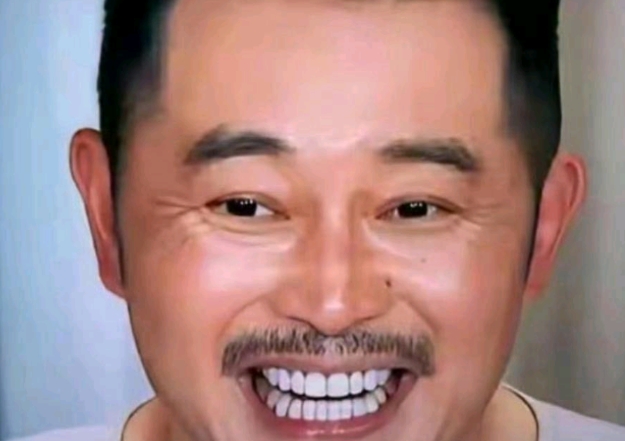 沙溢为了美观做了牙齿贴片，就贴前面没贴后面。一笑就全暴露了。 