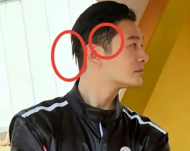 黄晓明现身青岛被拍,一头浓密黑发却是假发,假发分层很明显(黄晓明假发套)-第5张图片-九妖电影 黄晓明现身青岛被拍,一头浓密黑发却是假发,假发分层很明显(黄晓明假发套)-第5张图片-九妖电影