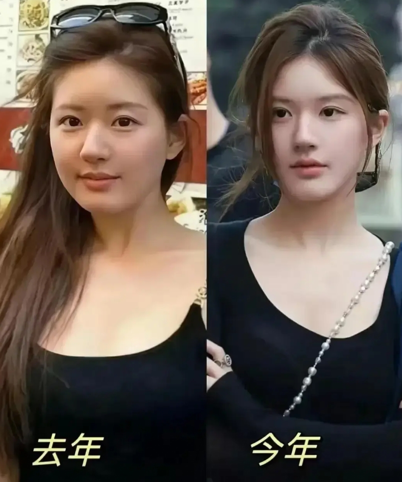 赵露思瘦出了病态！她身高161cm，体重却不足70斤！连一个11岁孩子的体重都达