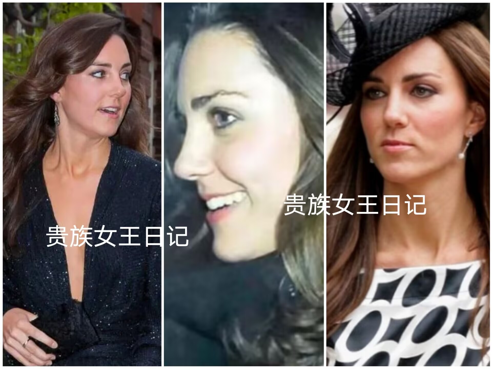 凯特王妃脸部的秘密，名人圈心照不宣，美丽动人的背后用金子堆砌（凯特王妃的面相）-第2张图片-九妖电影