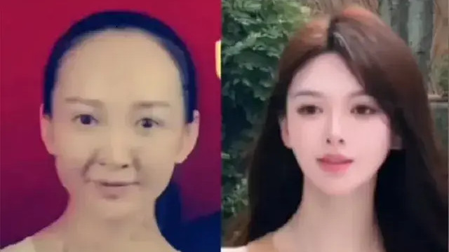 笑不活了！黄晓明女友叶珂回应整容传闻： 已整容40％，只能算微调