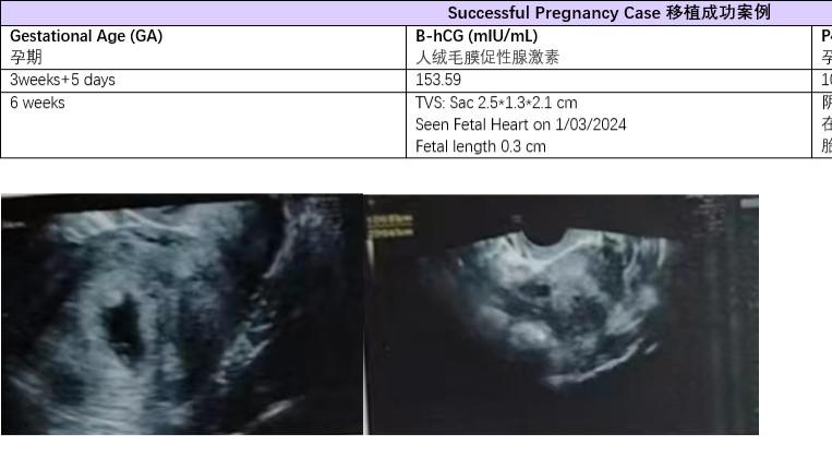 《我的促排移植成功之路：弱应答者的希望之旅》