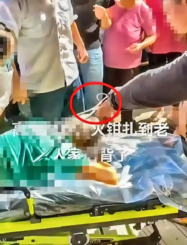 还有比这更倒霉的吗，9月27日江苏80岁老太太，啥都没干，就只是在小区里遛弯，没