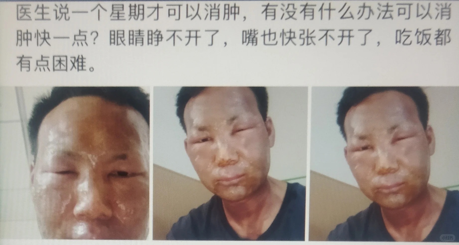 这么严重了还在搞笑，他真的我哭死
真的会被乐观的人笑鼠