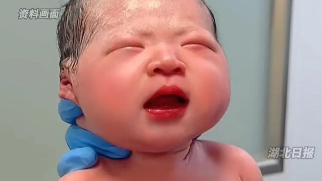宜昌鼓励合法生育妇女，产假延长至1 年。配偶护理假延长至30天