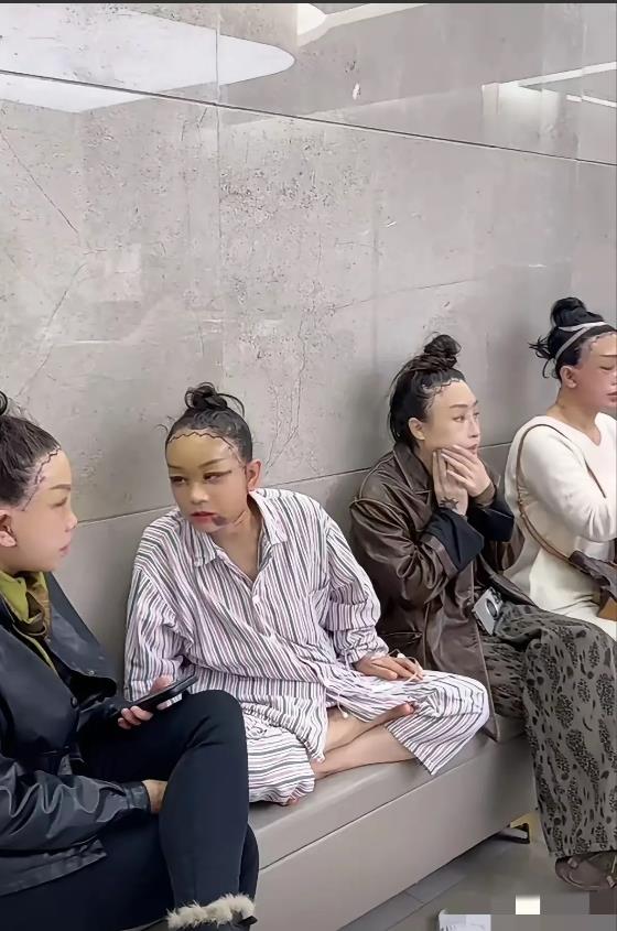 她们脸上动刀真的不疼吗？