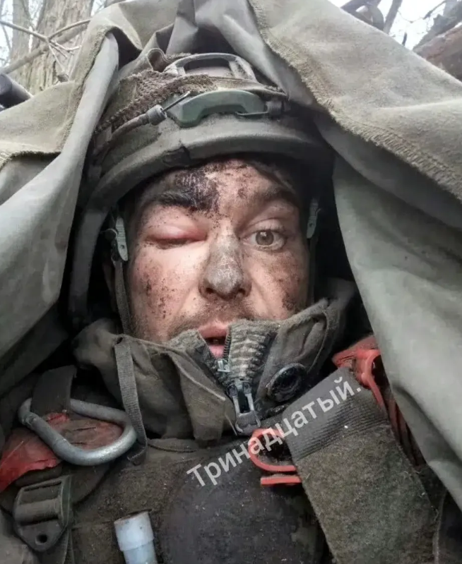 最近，俄军又冒出个“硬汉”。一名155海军陆战队的士兵，在库尔斯克打仗时，被流弹