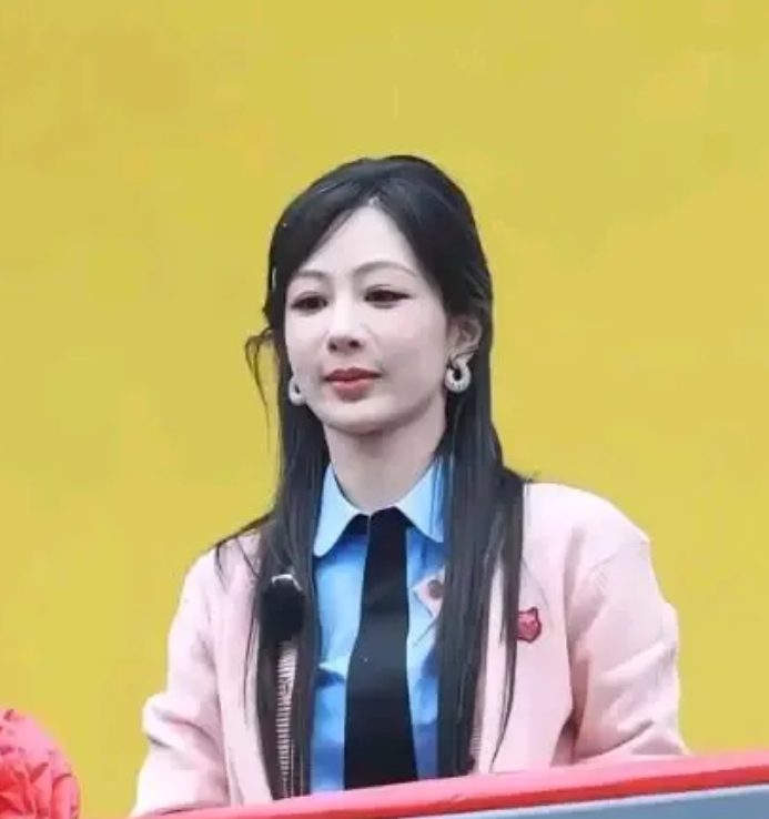 很奇怪啊！

我看网上很多人都说她整容了，但是为什么她嘴角的法令纹一直都在呢？十