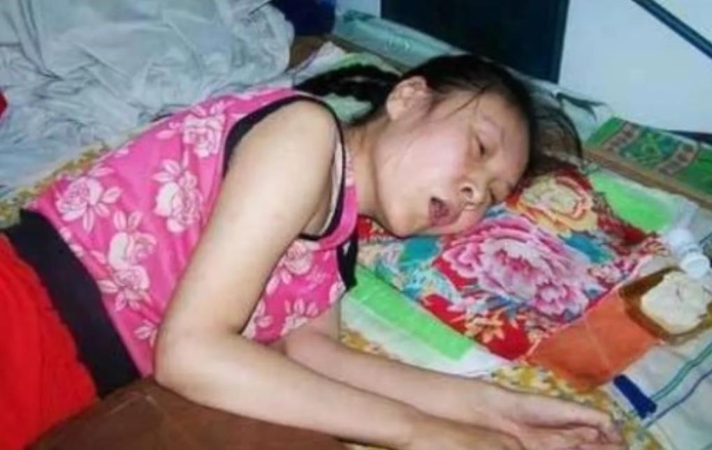 河北15岁女孩，被哥哥打了2巴掌后突然瘫痪，卧床近20年，父母离开后嫂子照顾她，