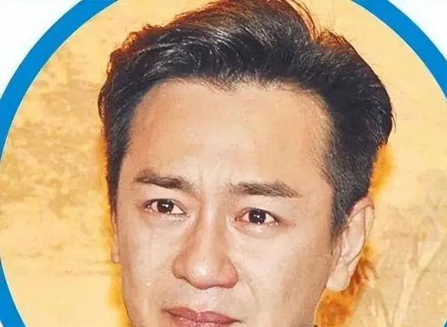 宁愿丑成“怪物”也要永葆青春，这7位明星早已整的“惨不忍睹”（十大明星整容失败）-第9张图片-九妖电影