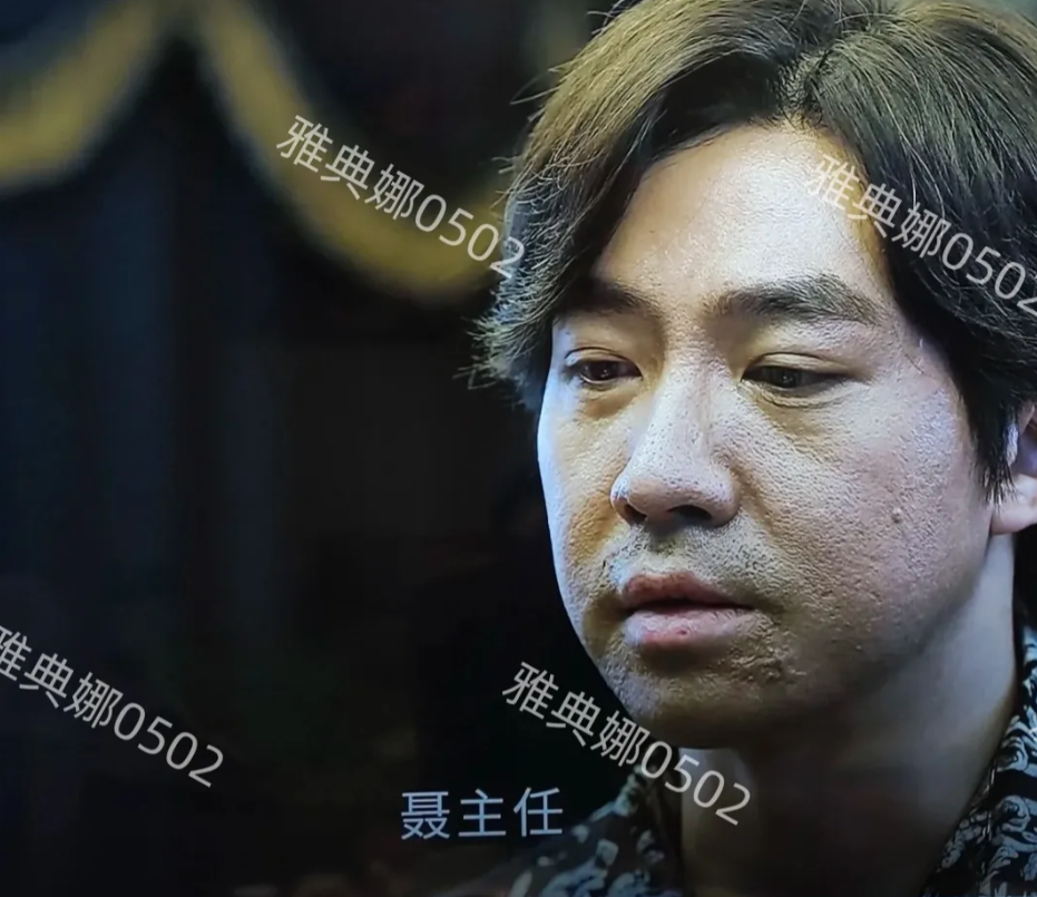 俞灏明的演技很好，但高清镜头下是脸依然触目惊心，厚厚是粉底还是盖不住烧伤的疤痕。