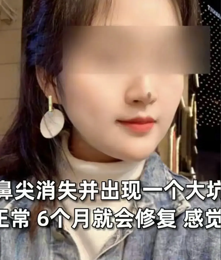 一位美丽的女孩，因一颗长在鼻尖的大痣而感到自卑。在受到美容院的广告吸引后，她决定