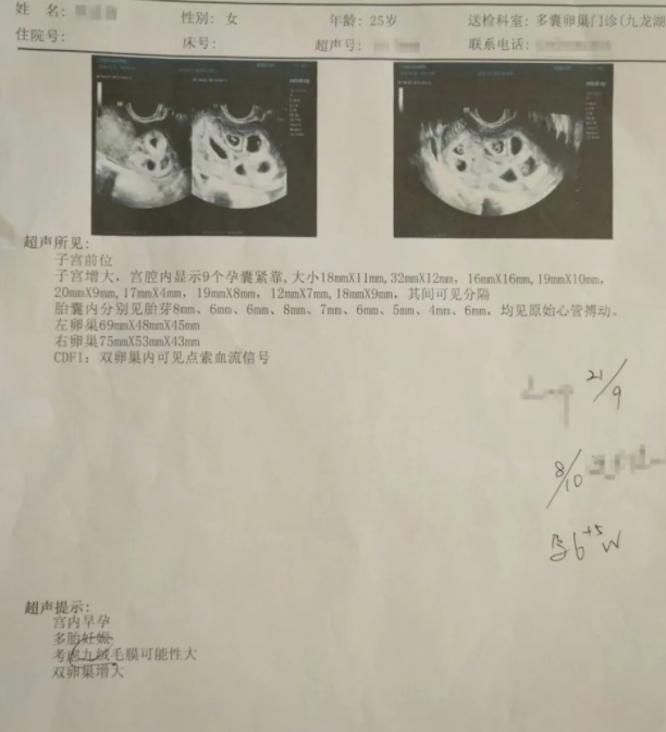 这该惊还是喜？江西南昌，女子结婚后一直没有怀孕，一家人急得不行，没成想，好不容易