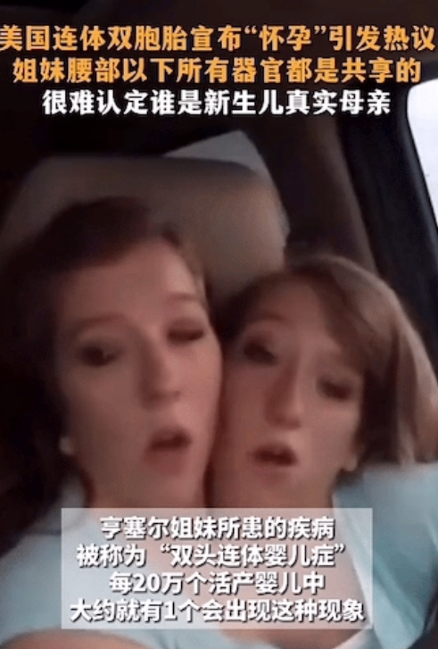 不得不说美国是一个包容性很强的国家，美国连体双胞胎姐妹，其中一个宣布怀孕，她们腰